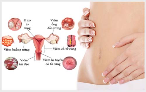 Viêm nhiễm phụ khoa gây nên nhiều biến chứng cho hệ thống sinh sản của người phụ nữ