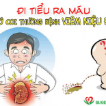 di-tieu-ra-mau-dau-hieu-nhan-biet-benh-viem-nieu-dao-o-nam-gioi