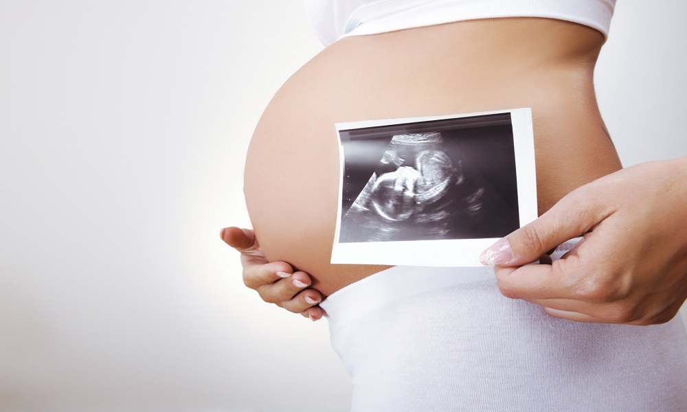 Siêu âm 2d là áp dụng tuổi thai từ 18-20 tuần