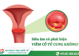 sieu-am-co-phat-hien-viem-co-tu-cung-khong