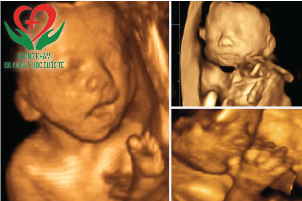 Hình ảnh siêu âm 4D thai 24 tuần ở nhiều góc độ khác nhau