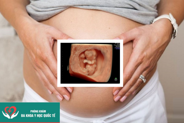 Siêu âm 4d thai 12 tuần phát hiện dị tật