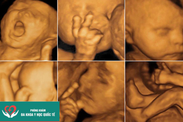 hình ảnh siêu âm 4d thai 22 tuần