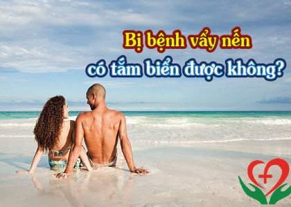 vay-nen-co-tam-bien-duoc-khong