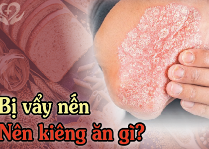 nam-gioi-bi-vay-nen-kieng-an-gi