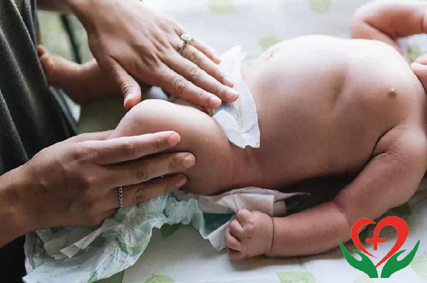 Ba mẹ nên làm gì để phòng ngừa sưng tinh hoàn ở trẻ sơ sinh